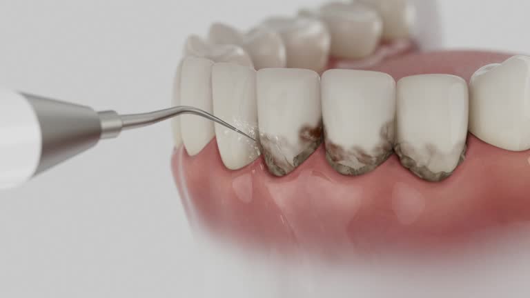 Trusted Teeth Cleaning And Checkup service in Lofall, WA - Dentist Open Now
